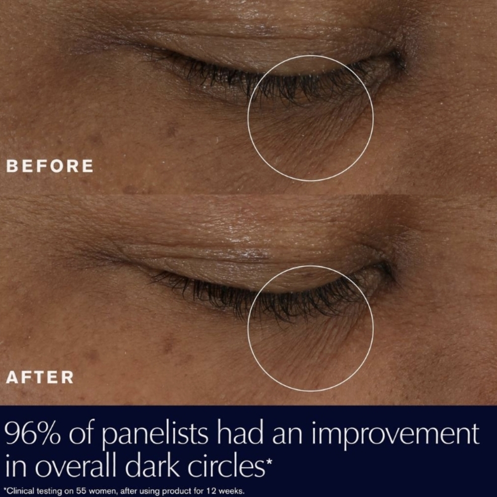 Estee Lauder Advanced Night Repair Eye Supercharged Gel-Creme - Picture 4 of 14
